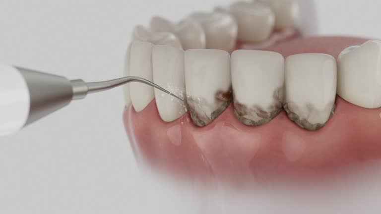 Trusted Root Canal Treatment service in Navasota, TX - Dentist Open Now